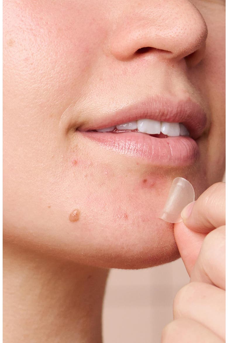 Mighty Patch Micropoint™ for Blemishes, Alternate, color, NO COLOR