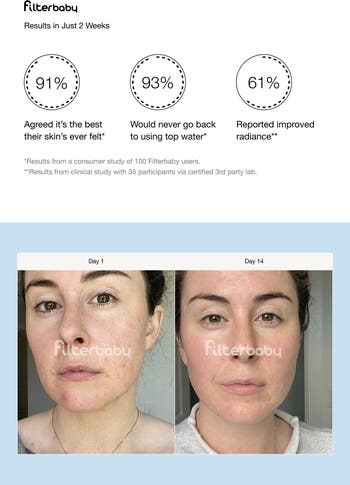 Skincare Water Filter + 2 Filter Refills $170 Value
