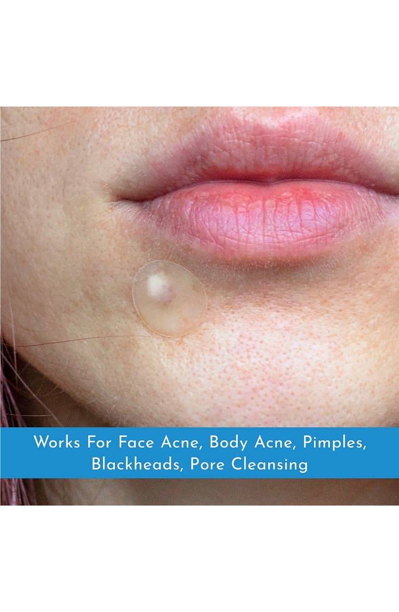 TRULY CLEAR Super Dots 72 Count Hydrocolloid Patches, 2 Sizes, Alternate, color, 