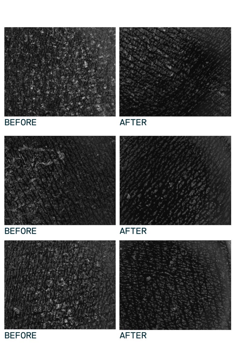 VENN SKINCARE Moisture-Balance All-In-One Face Cleanser, Alternate, color, 