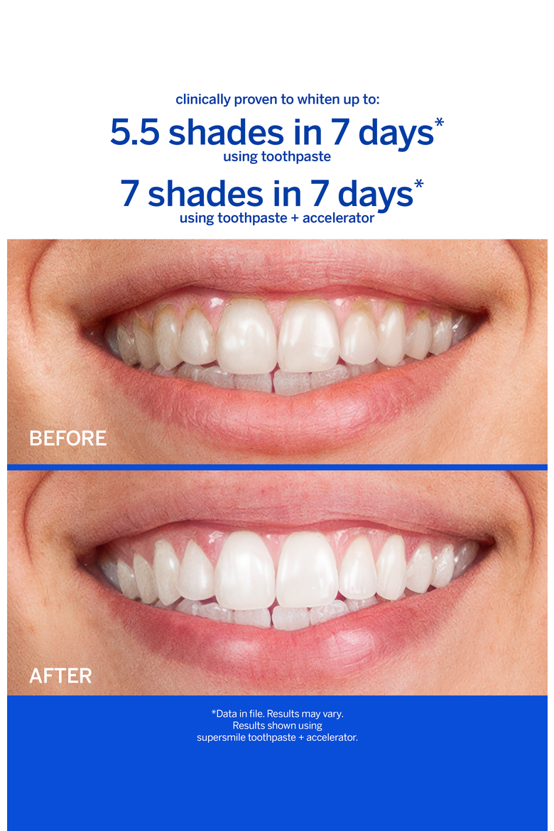 Professional Whitening Toothpaste - Cinnamon, Alternate, color, White