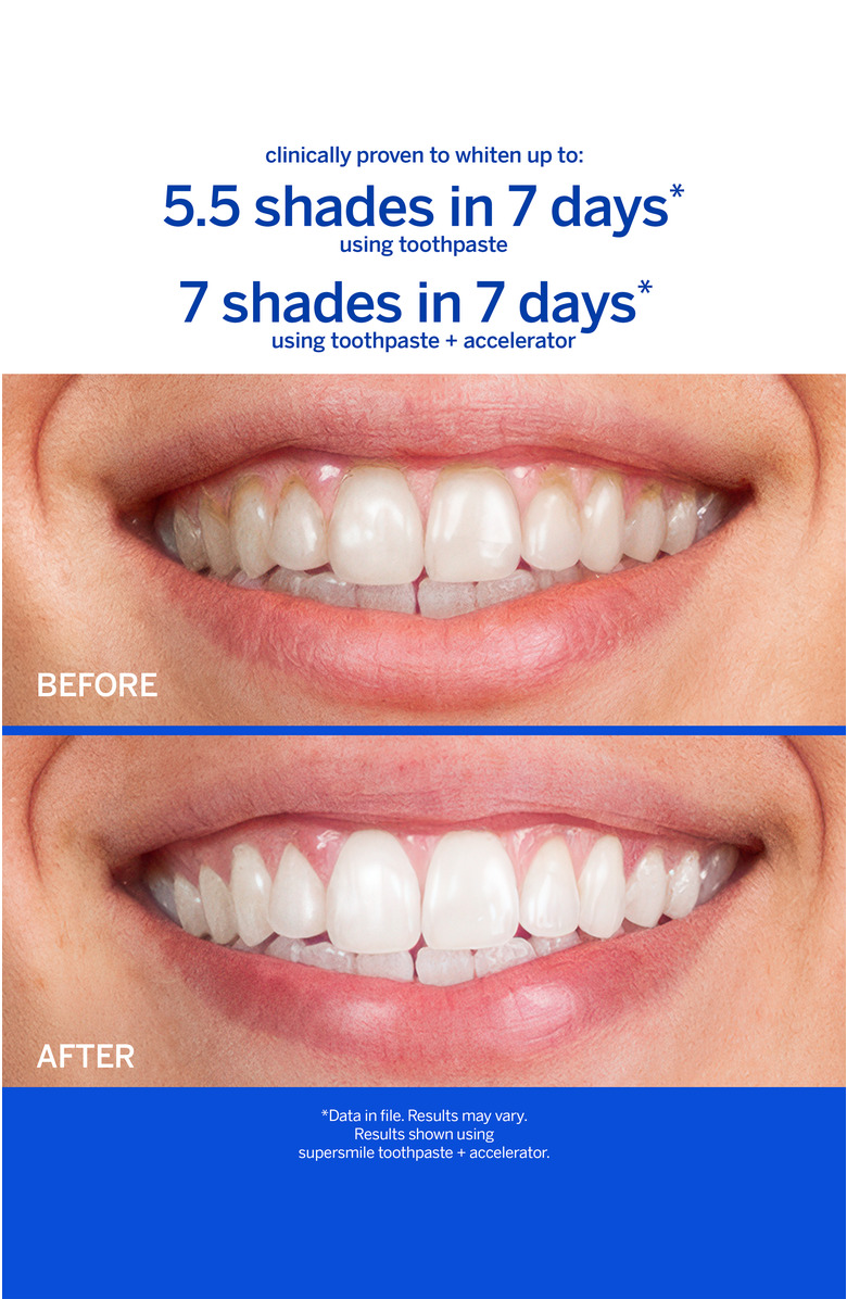 Supersmile Professional Whitening Toothpaste - Cinnamon, Alternate, color, White