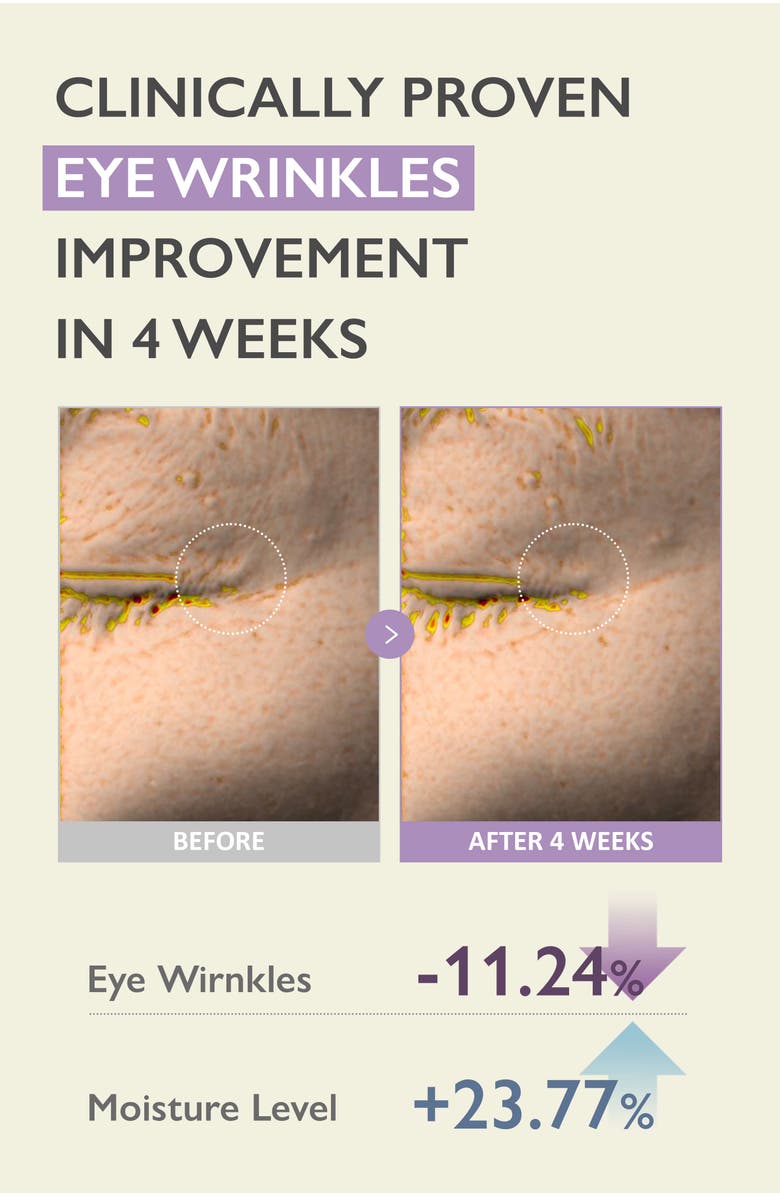 haruharu wonder Black Rice Bakuchiol Eye Cream, Alternate, color, 