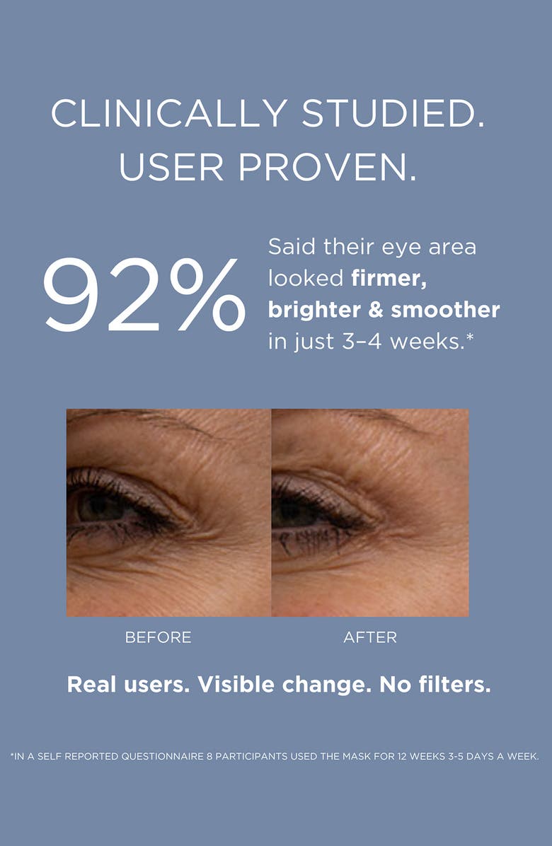 SOLARIS LABORATORIES NY LED Eye Refresh Pro Eye Mask Tool for Rejuvenated Eyes, Alternate, color, White