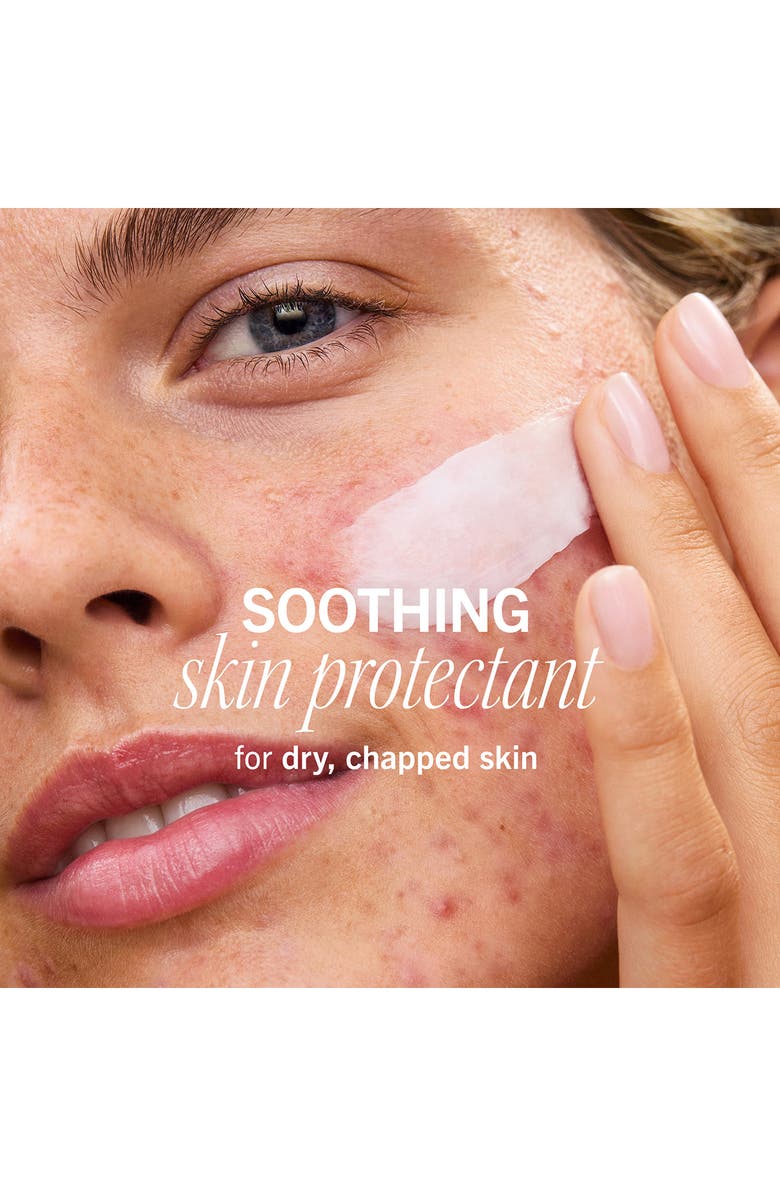 First Aid Beauty Ultra Repair Rescue Barrier Balm with Dimethicone, Alternate, color, 