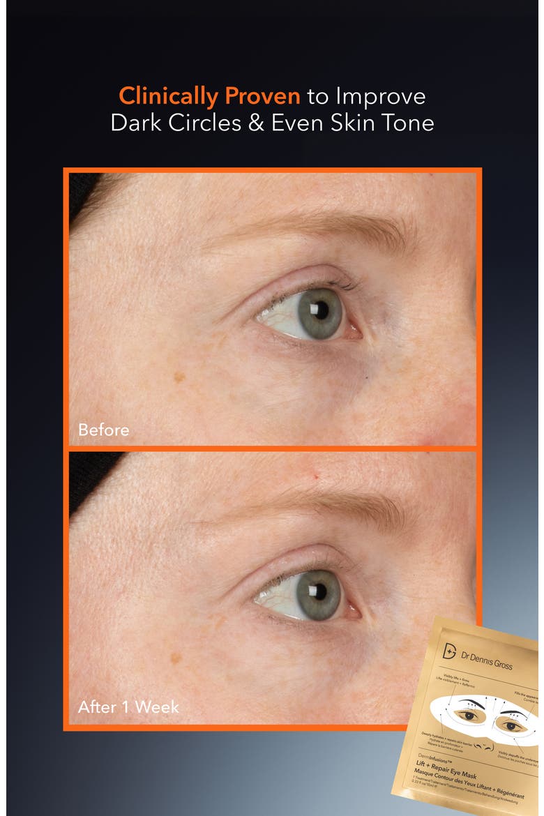 DermInfusions Lift + Repair Eye Mask, Alternate, color, NO COLOR