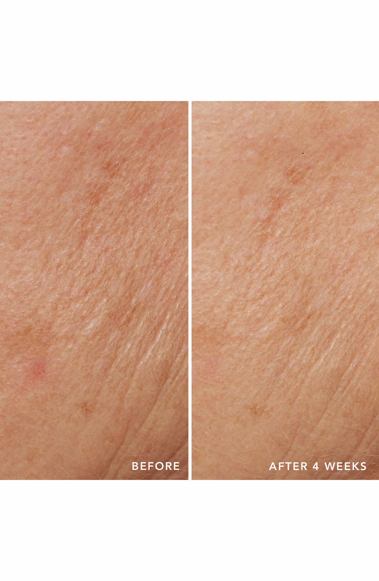 LANCER Skincare Triple Peptide Drops with Vitamin E + Niacinamide, Alternate, color, 