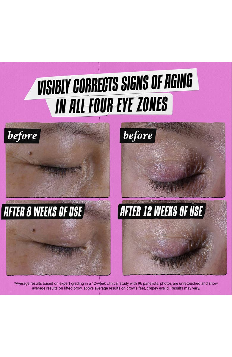 Kiehl's Since 1851 Super Multi-Corrective Eye Zone Treatment Cream, Alternate, color,