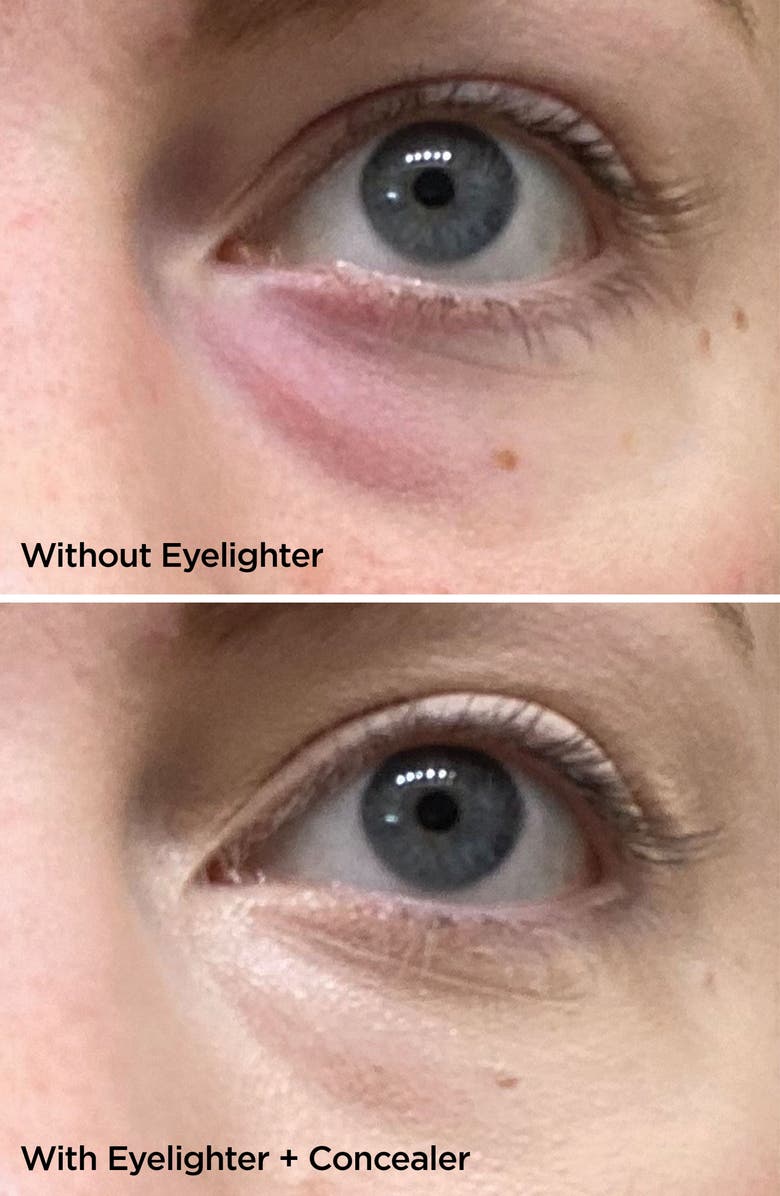 BeautyBio The Eyelighter Concentrate Smoothing, Brightening Serum & Depuffing Tool, Alternate, color,