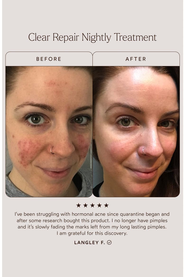 Clear Repair Serum, Alternate, color, NO COLOR