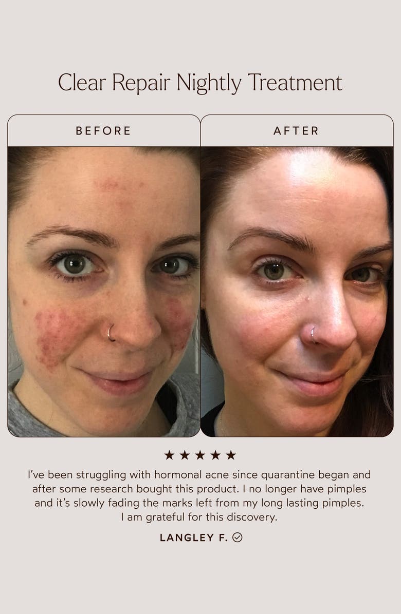 True Botanicals Clear Repair Serum, Alternate, color, 