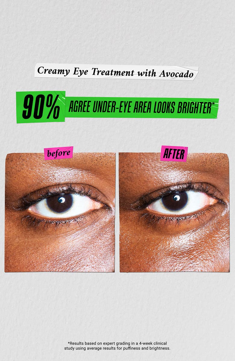 Kiehl's Since 1851 An Avo Toast to Bright Eyes Duo $79 Value, Alternate, color, 