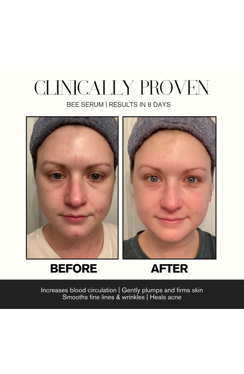Intoxicated Cosmetics Bee Serum and Mini Bee, Alternate, color, NO COLOR