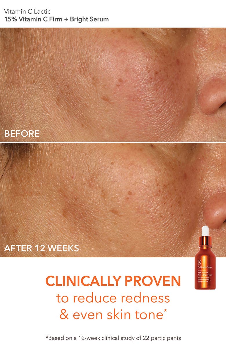 Dr. Dennis Gross Skincare Bright & Tight Delights Skin Care Set, Alternate, color,