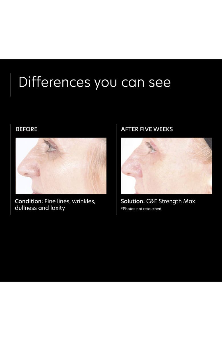 PCA Skin C&E Strength Max Treatment, Alternate, color,