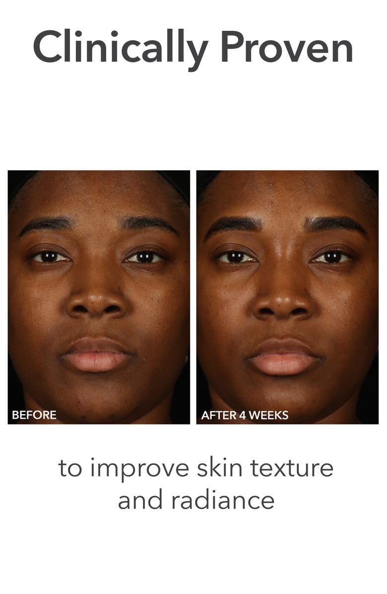 Dr. Dennis Gross Skincare Alpha Beta<sup>®</sup> pH Balance Replenishing Cream, Alternate, color,