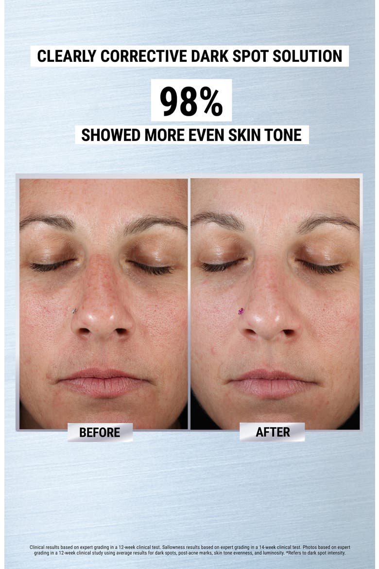 Brighten & Hydrate Skin Care Set USD $96 Value, Alternate, color, NO COLOR