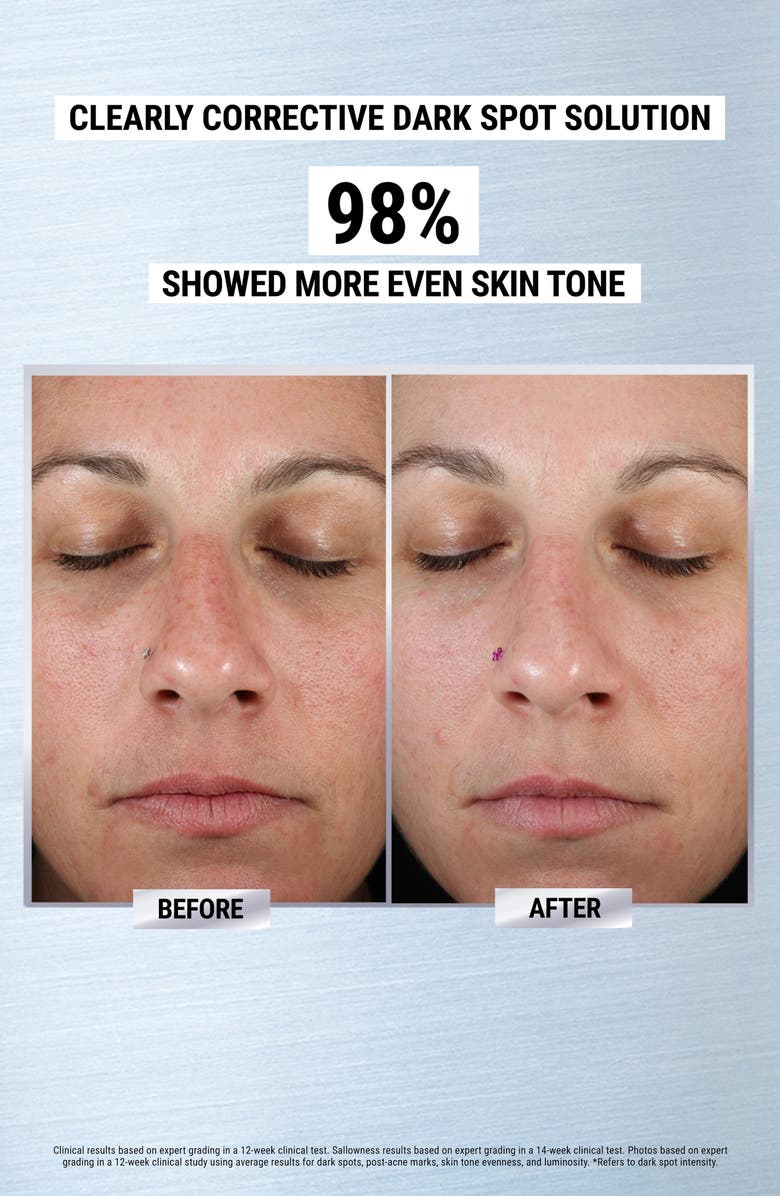 Kiehl's Since 1851 Brighten & Hydrate Skin Care Set USD $96 Value, Alternate, color,