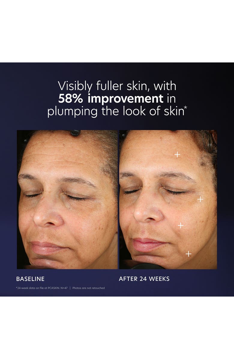 PCA Skin Pro-Max Age Renewal Serum, Alternate, color,