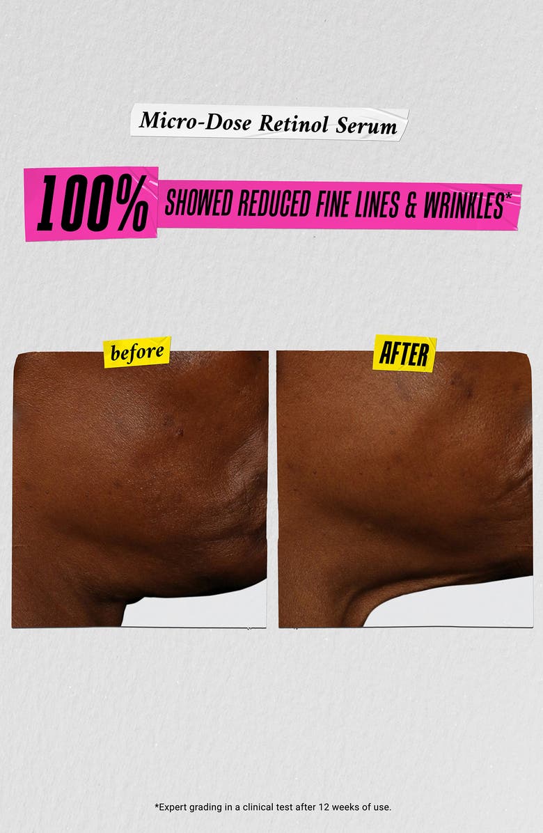 Kiehl's Since 1851 Dare to Derm Skin Care Gift Set $163 Value, Alternate, color,