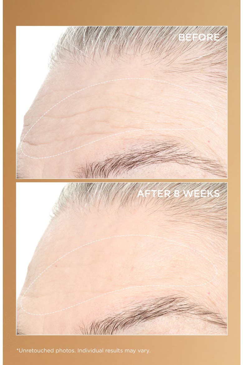 Neuropeptide Pro-Strength Firming Moisturizer, Alternate, color, NO COLOR