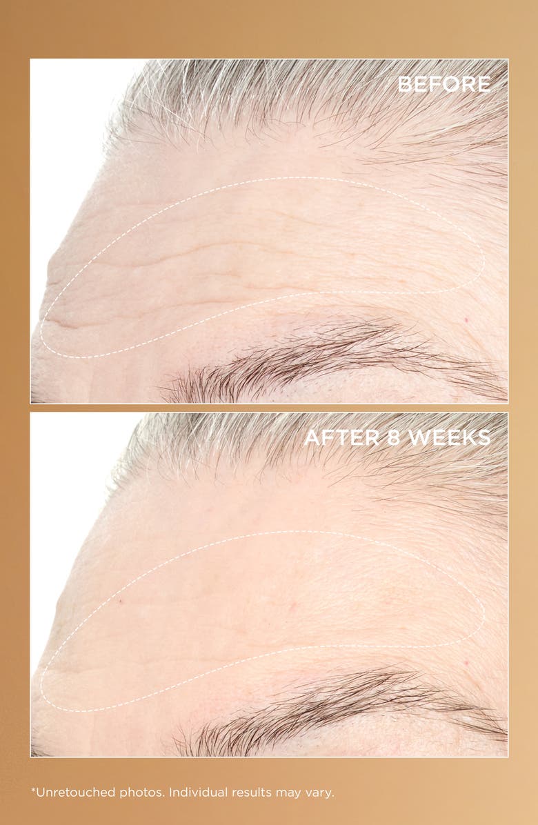 Perricone MD Neuropeptide Pro-Strength Firming Moisturizer, Alternate, color,