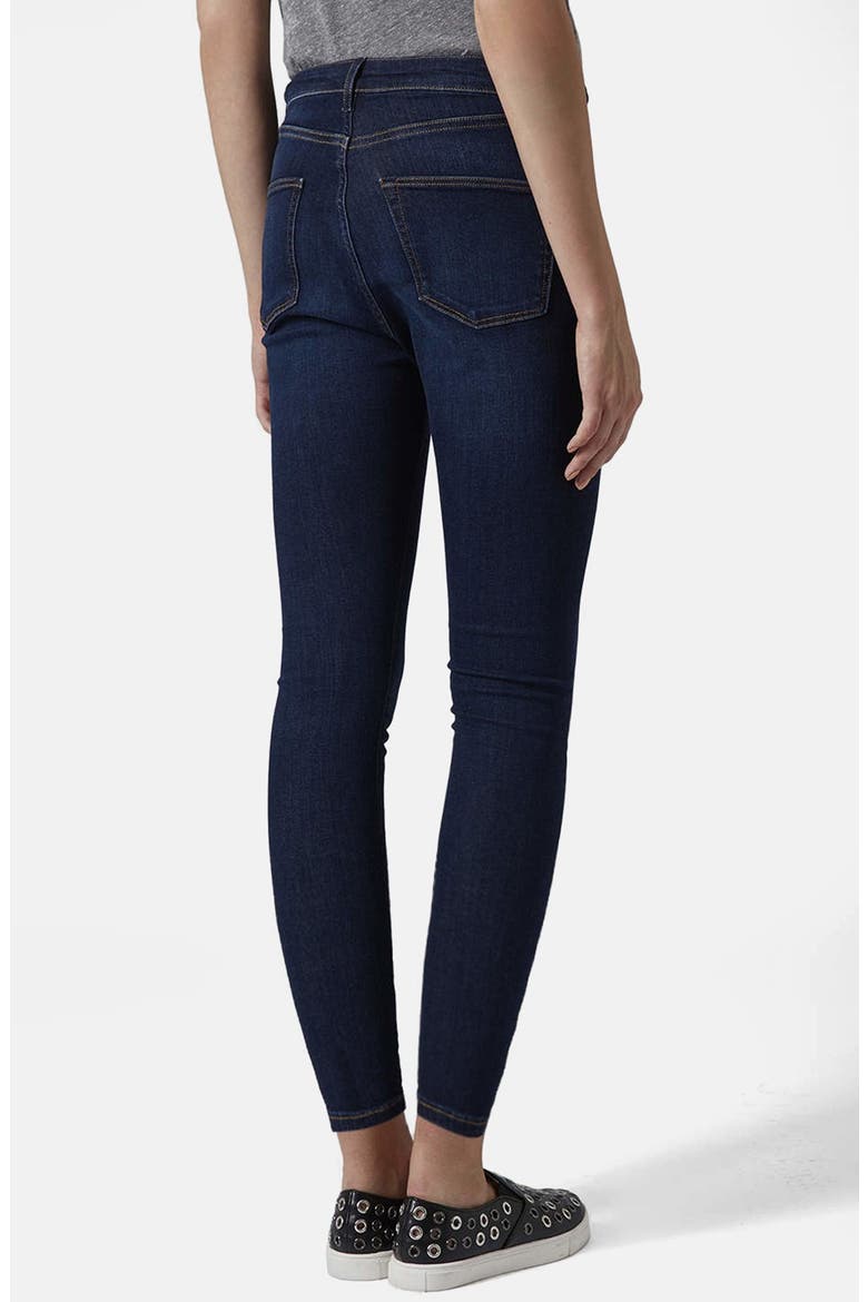 Moto 'Jamie' Vintage High Rise Jeans, Alternate, color, DARK DENIM