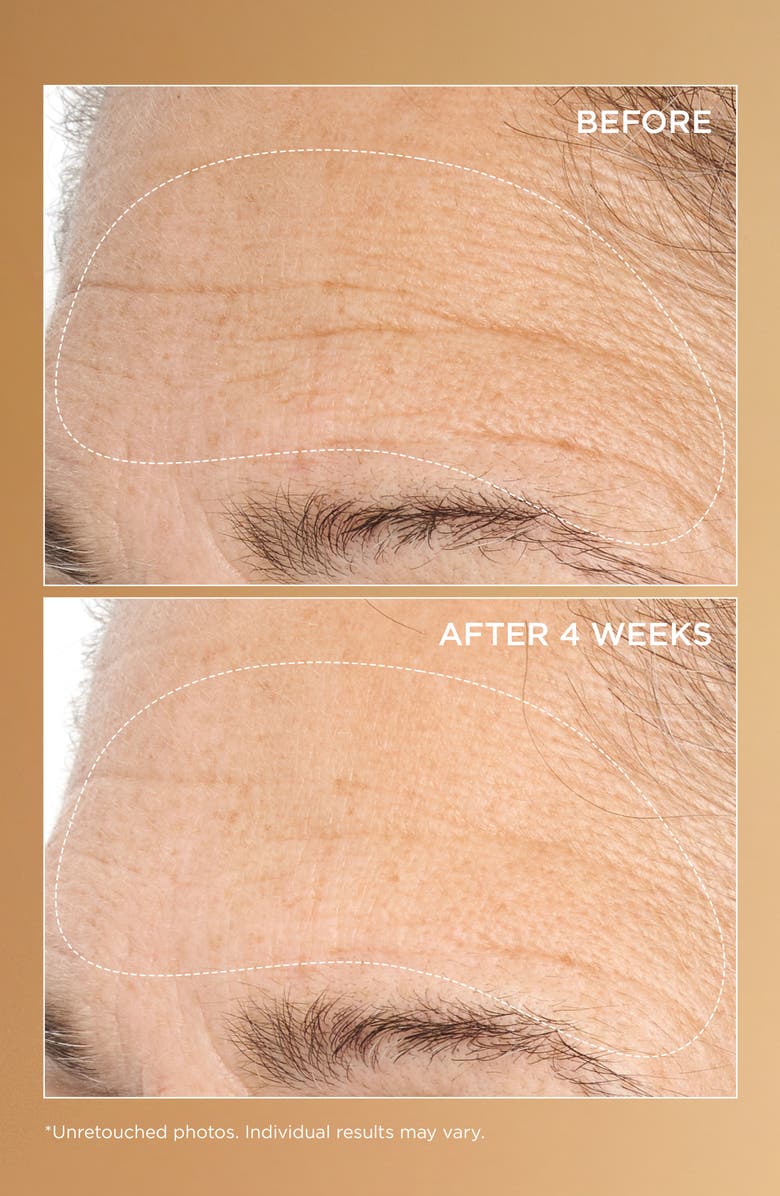 Perricone MD Neuropeptide Deep Crease Serum, Alternate, color, 