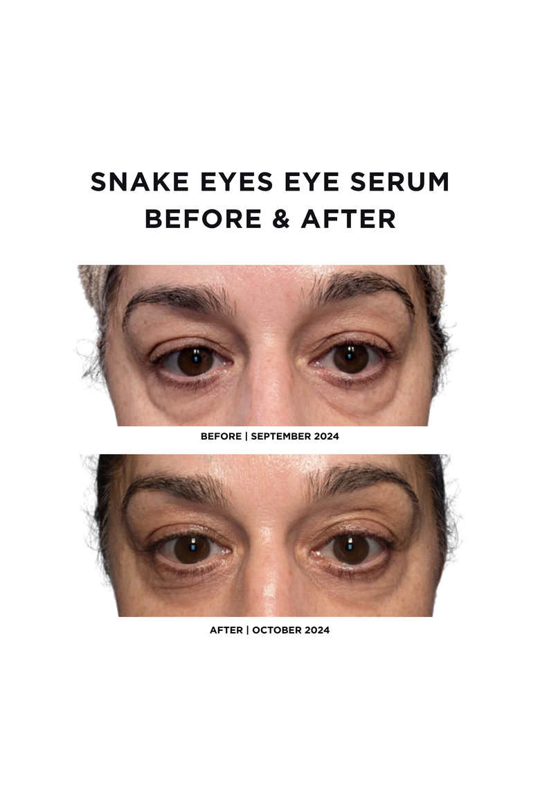 Snake Eyes | Eye Serum | 0.68 fl.oz/20mL  - Lifting Formula for Daily Moisture and Eye Contour, Alternate, color, None