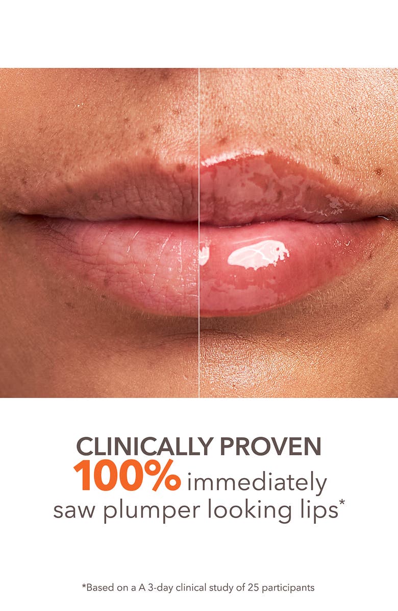 Dr. Dennis Gross Skincare DermInfusions<sup>™</sup> Plump + Repair Lip Treatment, Alternate, color, Clear