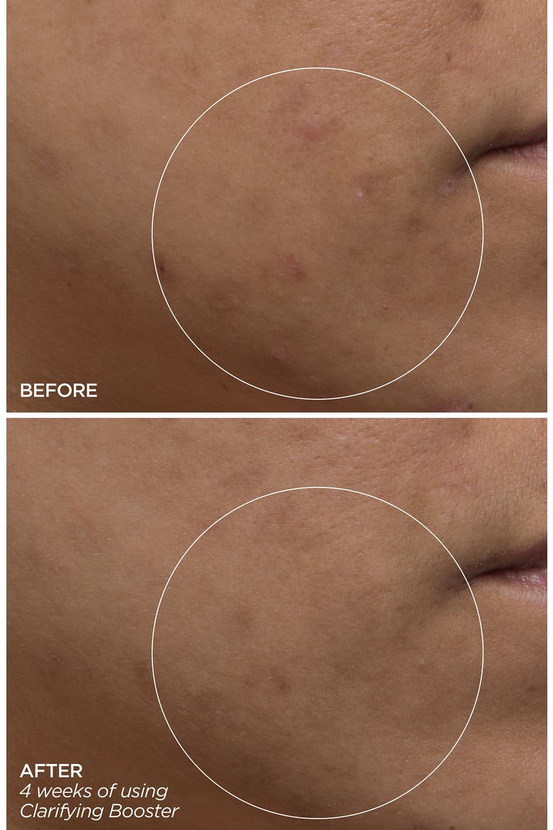 Clarifying Salicylic Acid Booster Serum, Alternate, color, NO COLOR