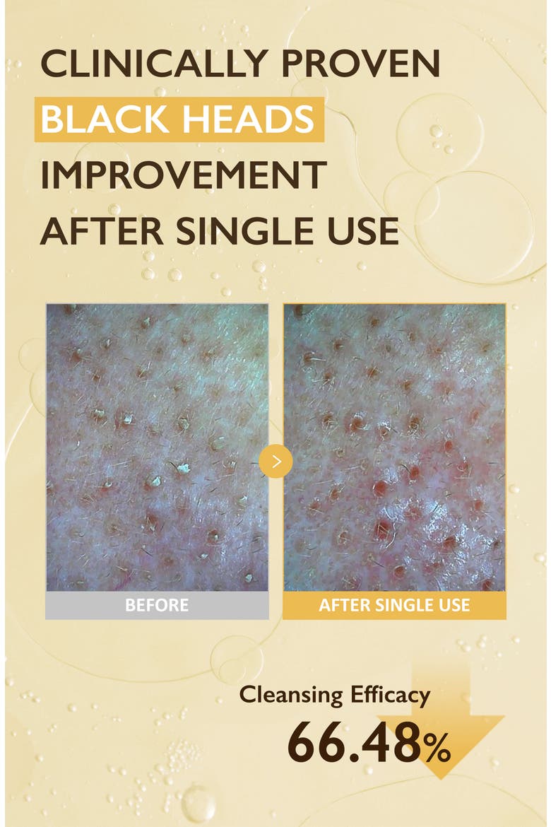 Black Rice Moisture Cleansing Oil, Alternate, color, None