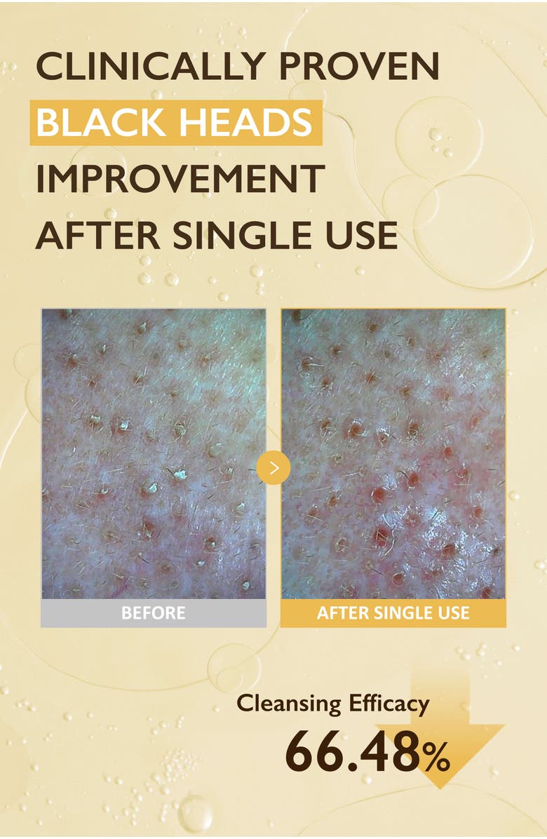 haruharu wonder Black Rice Moisture Cleansing Oil, Alternate, color, NO COLOR