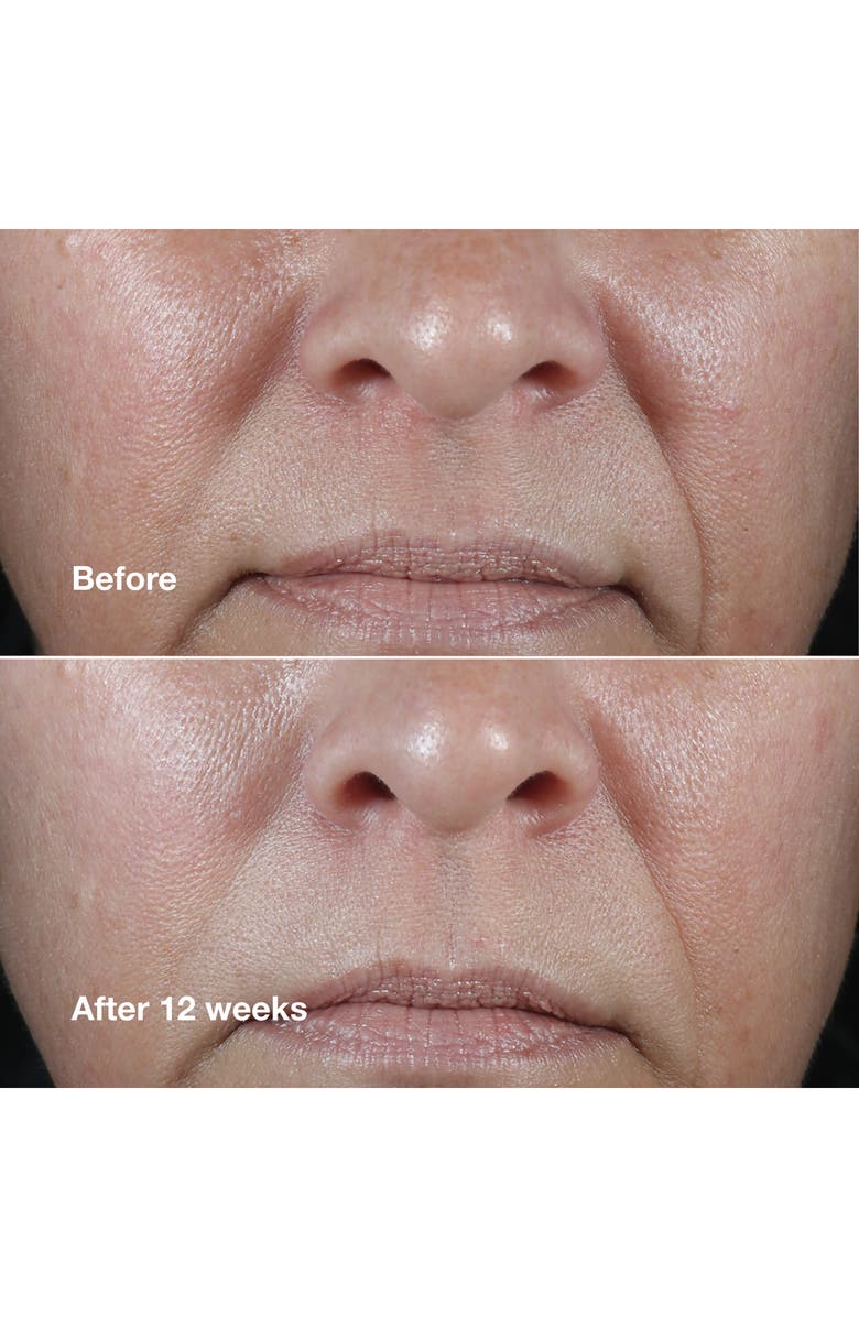 Clinique Smart Clinical Repair Wrinkle Correcting Rich Face Cream, Alternate, color,