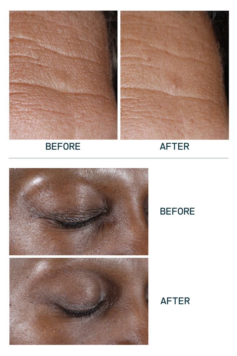 Age-Reversing All-In-One Concentrate, Alternate, color, NO COLOR