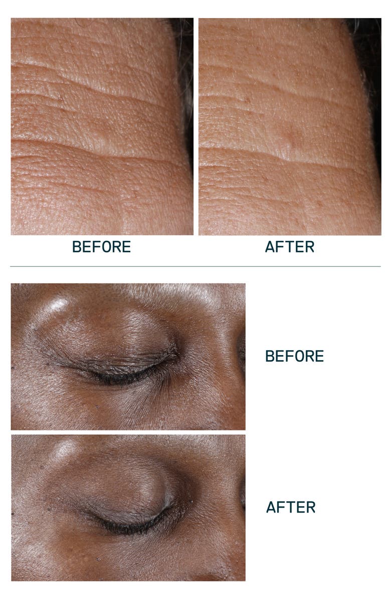 VENN SKINCARE Age-Reversing All-In-One Concentrate, Alternate, color, 