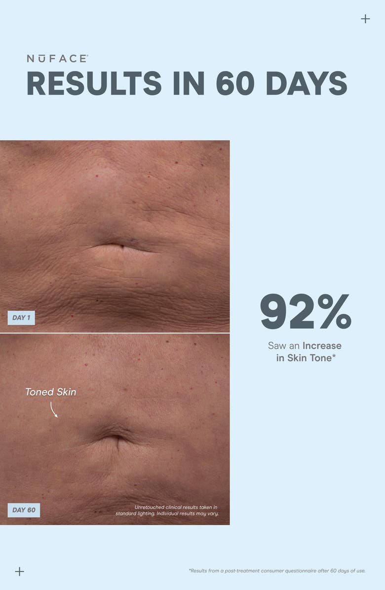 NuFACE<sup>®</sup> NuBODY Skin Toning Microcurrent Device Kit $479 Value, Alternate, color, 