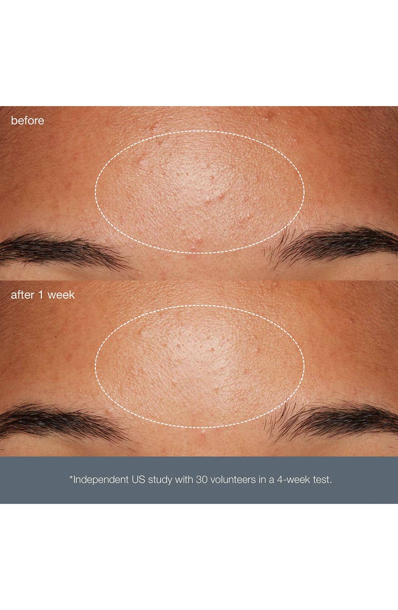 dermalogica<sup>®</sup> Daily Microfoliant<sup>®</sup>, Alternate, color, 