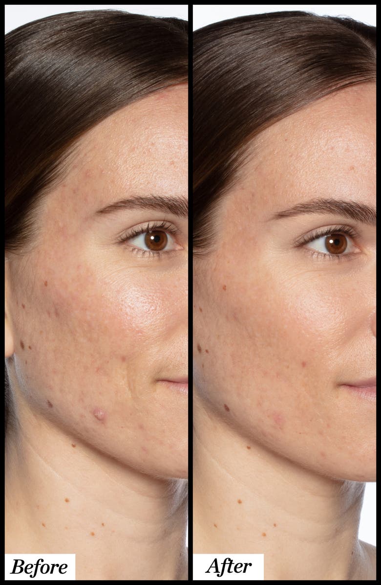 Sunday Riley Good Genes Home & Away Set $184 Value, Alternate, color,