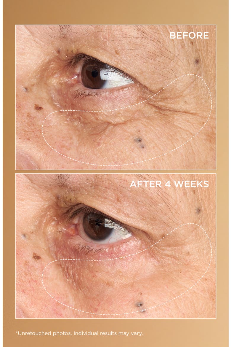 Neuropeptide Brightening Under-Eye Cream, Alternate, color, NO COLOR