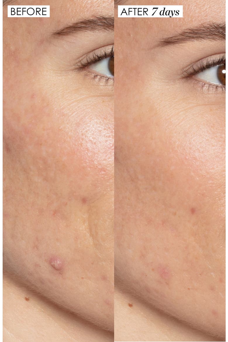 Good Genes All-in-One Lactic Acid Exfoliating Face Treatment Serum, Alternate, color, NO COLOR