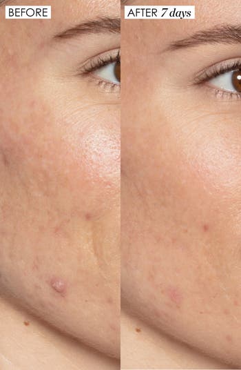Good Genes All-in-One Lactic Acid Exfoliating Face Treatment Serum