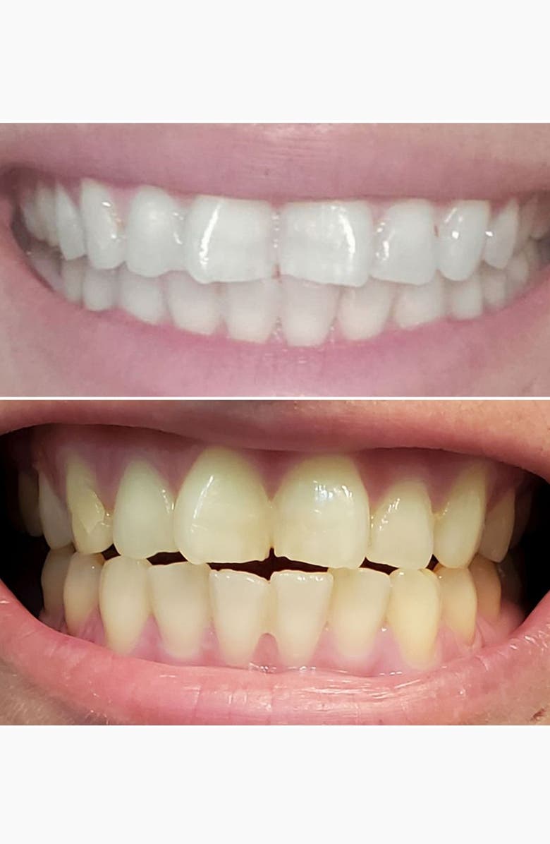 SNOW Diamond Dissolving Teeth Whitening Strips, Alternate, color, 