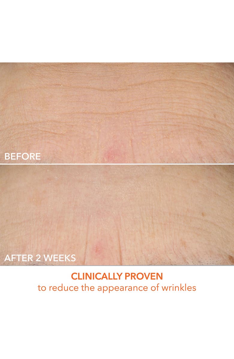 Dr. Dennis Gross Skincare Vitamin C Lactic Dewy Deep Cream, Alternate, color, 