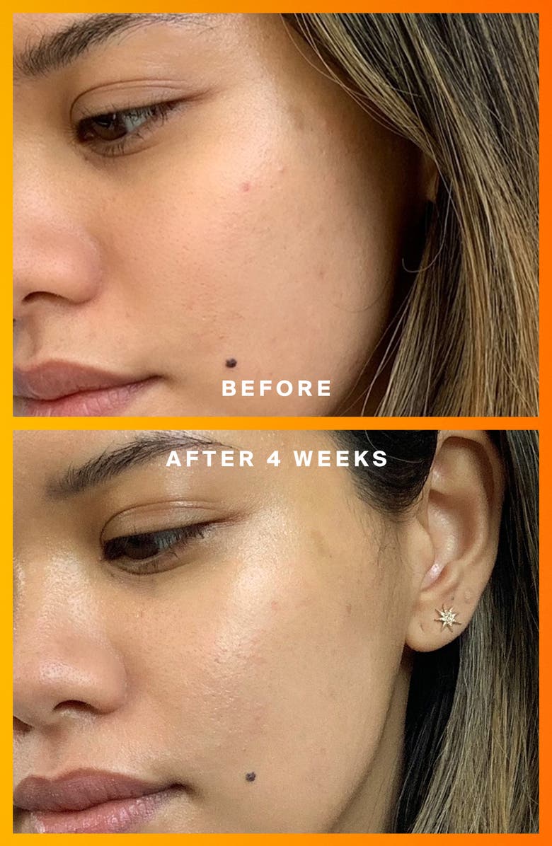 Supergoop!<sup>®</sup> Daily Dose Vitamin C + SPF 40 Serum, Alternate, color, 