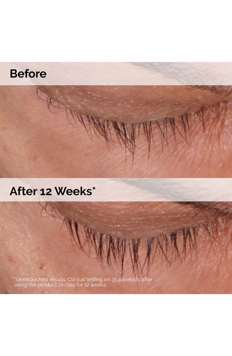 The Ordinary Multi-Peptide Lash and Brow Serum for Thicker Lashes & Brows, Alternate, color,