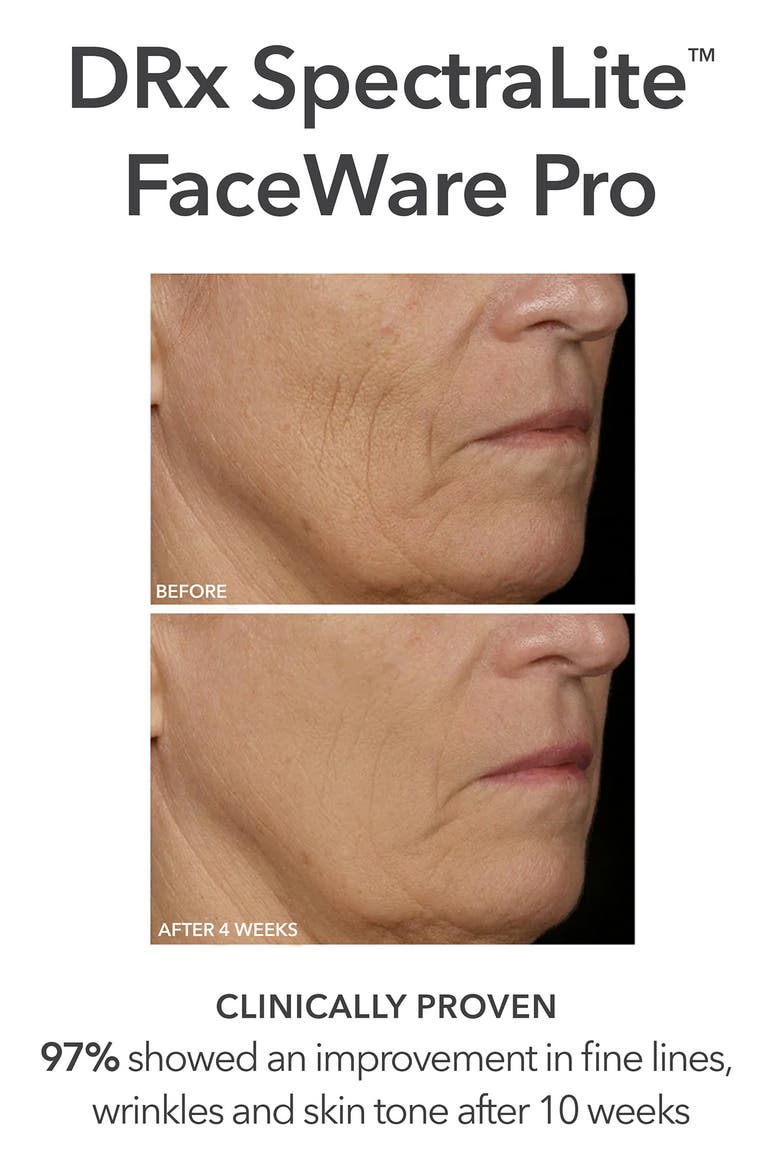 Faceware Pro Set $568 Value, Alternate, color, NO COLORDNU