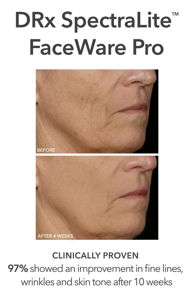 Plump, Glow & Boost Collagen Set $568 Value
