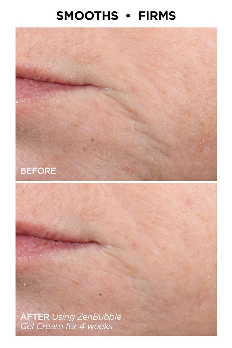 Zen Skin Duo $168 Value, Alternate, color, NO COLOR
