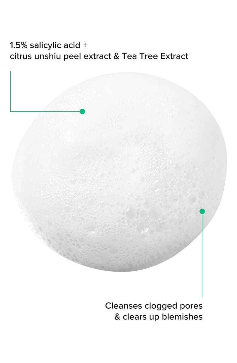 I DEW CARE Clean Zit Away Foam Cleanser, Alternate, color, 